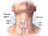 थाइरॉयड 