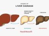 Liver disease यकृत रोग
