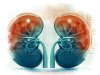 किडनी खराब