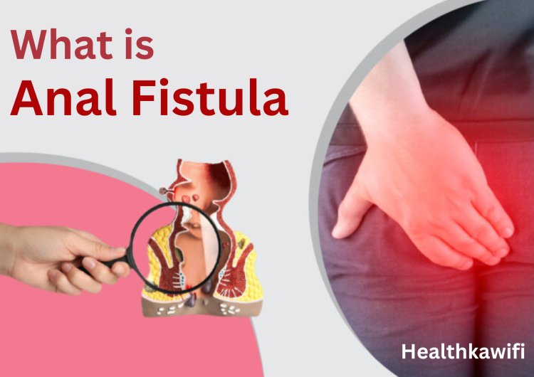 Fistula भगंदर