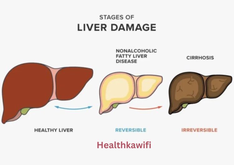 Liver disease यकृत रोग